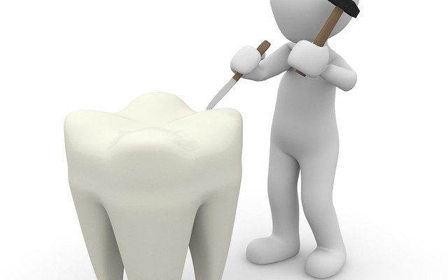 Jaki antybiotyk warto zastosować na ból zęba?